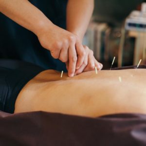 Best Acupuncture clinic in New Cairo