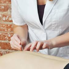 Best Acupuncturist in Nasr city