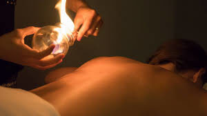 Fire Cupping Therapy in egypt